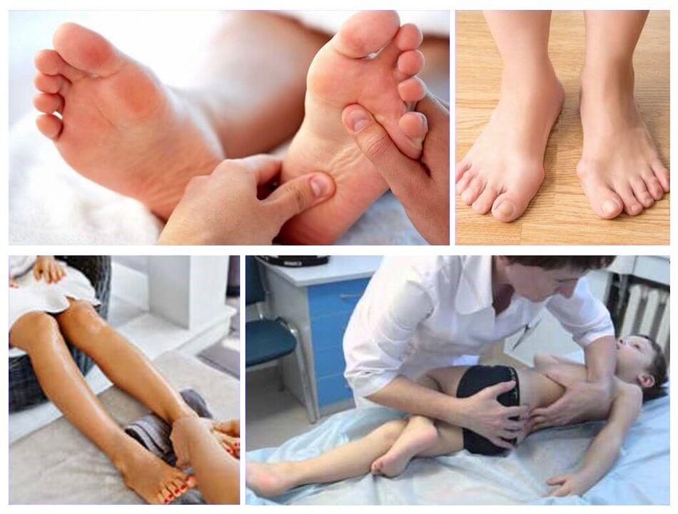 Deformace valgus u léčby dětí
