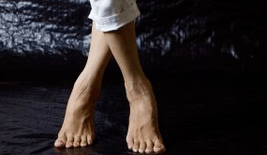 Valgus deformace