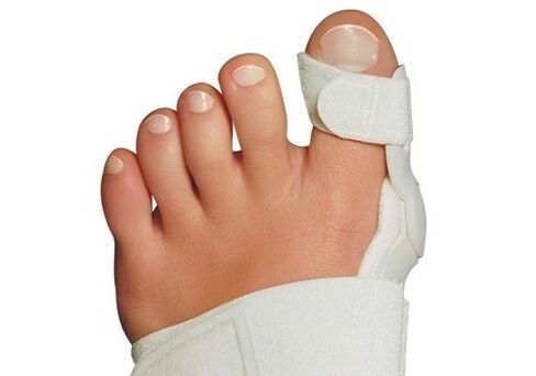 Valgus deformace