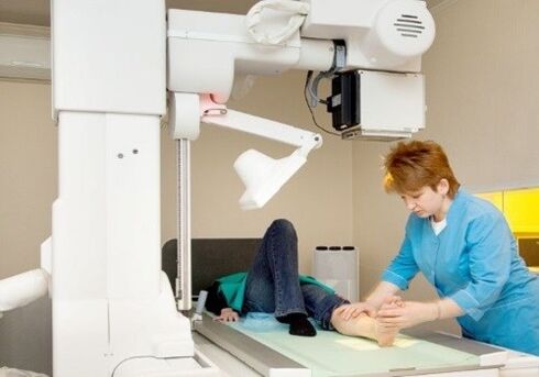 X -ray nohy